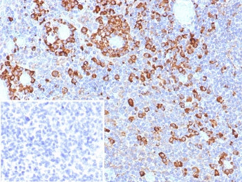 IHC staining of FFPE human tonsil tissue with CD9 antibody (clone CD9/7417). Inset: PBS used in plac