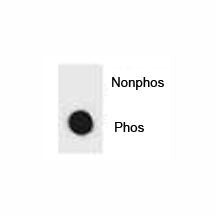 Dot blot analysis of phospho-IKK beta antibody. 50ng of phos-peptide or nonphos-peptide per dot were
