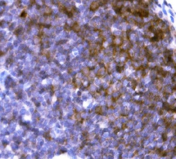 CD19 Antibody / B-lymphocyte marker