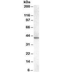 ABHD12 Antibody