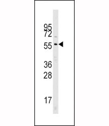 Western blot analysis of Cdc25A antibody and mouse kidney tissue lysate. Predicted molecular weight: