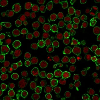 CD45RO Antibody (T-cell marker)