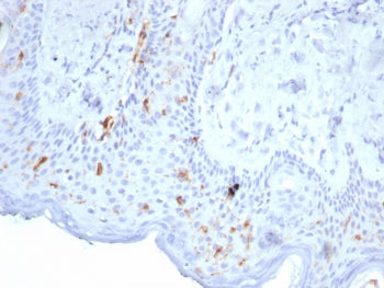 IHC staining of FFPE human skin tissue with Langerin antibody (clone LGRN/7356). HIER: boil tissue s