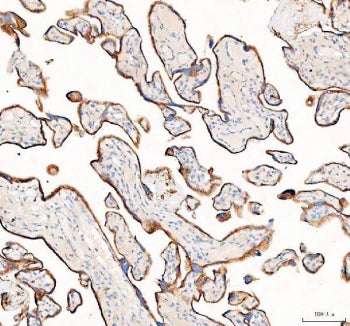 IHC staining of FFPE human placental tissue with 4-Alpha-glucanotransferase antibody. HIER: boil tis