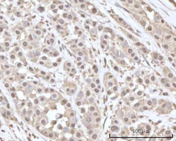 Recoverin Antibody