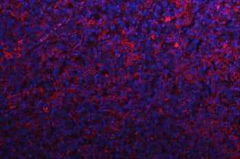 RPS15A Antibody / 40S ribosomal protein S15a