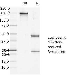 SDS-PAGE Analysis of Purified, BSA-Free DSG1 Antibody (clone 27B2). Confirmation of Integrity and Pu