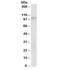 Western blot testing of human breast cancer lysate with NLRX1 antibody at 2ug/ml. Predicted molecula