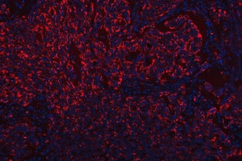 SCARB2 Antibody / SR-BII / LIMPII