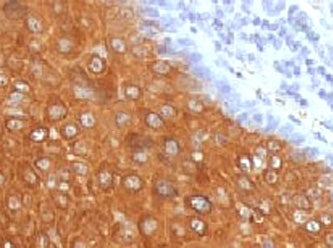 IHC testing of FFPE human skin with recombinant Cytokeratin 10 antibody (clone CTKN10-2R). Required 