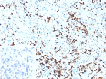 IHC staining of FFPE human spleen tissue with S100A4 antibody (clone S100A4/6801). Inset: PBS used i