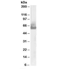 Western blot testing of U937 lysate with WASP antibody at 0.03ug/ml. Predicted molecular weight: ~53