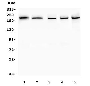 Western blot testing of human 1) HL60, 2) ThP-1, 3) A549, 4) U-2 OS and 5) HeLa cell lysate with SMA