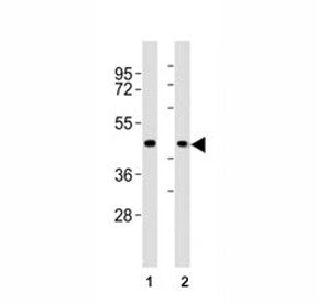 CCR1 Antibody