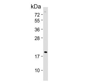 p19-INK4d Antibody / CDKN2D