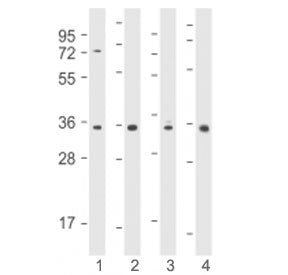 Western blot testing using Cyclin D1 antibody at 1:2000 : Lane 1) human MCF7, 2) human HT-1080, 3) m