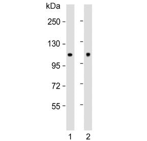 Western blot testing of human 1) MCF7 and 2) rat brain lysate with Hexokinase antibody. Predicted mo