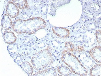 IHC staining of FFPE human kidney tissue with recombinant CDH2 antibody (clone rCDH2/8291). HIER: bo