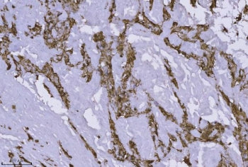 IHC staining of FFPE human leiomyoma of the vulva tissue with ANXA4 antibody. HIER: boil tissue sect