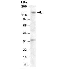 Western blot testing of human ovay lysate with GPR125 antibody at 0.5ug/ml. The expected ~140 kDa ba