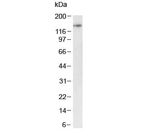Western blot testing of mouse testis tissue lysate with BRD4 antibody at 1ug/ml. Predicted molecular