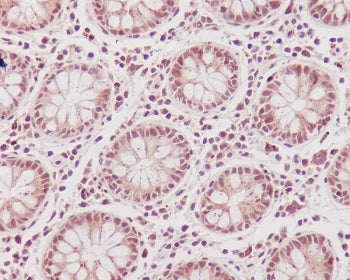 IHC staining of FFPE human colon tissue with CDK1 antibody. HIER: boil tissue sections in pH6, 10mM 