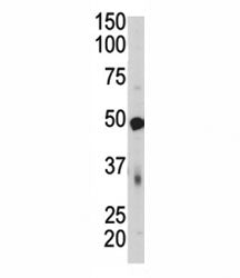 Western blot of PDK4 antibody and mouse skeletal muscle tissue lysate. Predicted molecular weight ~4