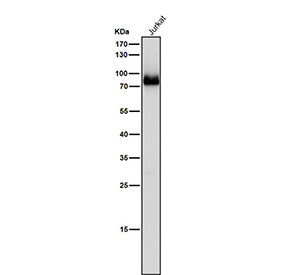 Western blot testing of human Jurkat cell lysate using the Pan-PKC antibody at 1:5000 dilution for 1