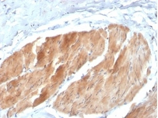 IHC staining of FFPE human bladder tissue with PIK3R2 antibody (clone PIK3R2/1293). HIER: boil tissu