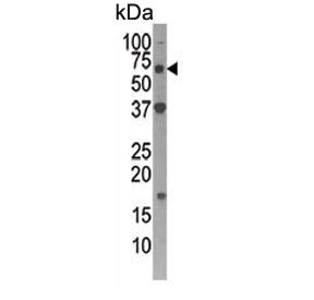 Western blot testing of human Y79 cell lysate with Autophagin 4D antibody. Expected molecular weight