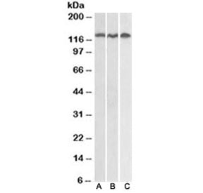 Western blot testing of Daudi (A), Jurkat (B) and HeLa (C) lysates with ADAM17 antibody at 0.3ug/ml.