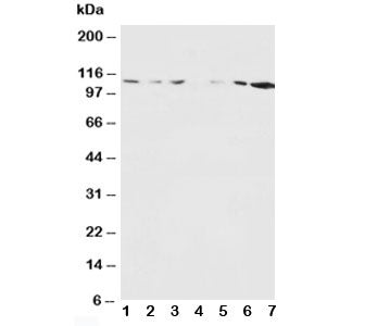 NMDAR1 Antibody