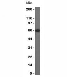 Estrogen Receptor alpha Antibody