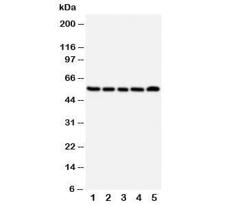 Western blot testing of NK1R antibody and Lane 1: A549; 2: U87; 3: COLO320; 4: SCG; 5: PANC cell lys