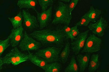 SNF2H Antibody / Sucrose nonfermenting protein 2 / SMARCA5