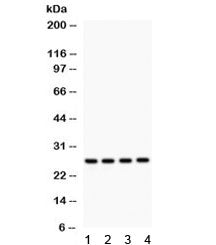 Western blot testing of 1) rat brain, 2) rat spleen, 3) rat kidney and 4) human SMMC lysate with Flt