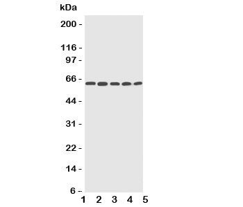 Western blot testing of CYP2U1 antibody and Lane 1: HeLa; 2: MCF-7; 3: MM453; 4: COLO320; 5: HT1080 cell lysate