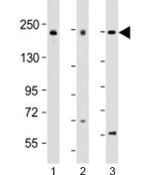 Western blot testing of human 1) A549, 2) Jurkat and 3) K562 cell lysate with PSME4 antibody at 1:20