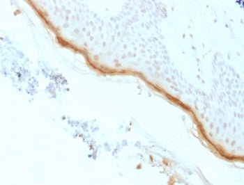 IHC testing of FFPE human skin with recombinant Filaggrin antibody (clone rFLG/1561). Required HIER: