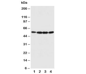 Western blot testing of Fascin antibody and Lane 1: U87; 2: A549; 3: MCF-7; 4: HT1080 cell lysate. P