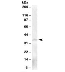 Western blot testing of human testis lysate with NANOS antibody at 0.3ug/ml. Predicted molecular wei