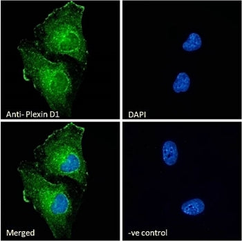 Immunofluorescent staining of fixed and permeabilized human U-251 cells with Plexin D1 antibody (gre