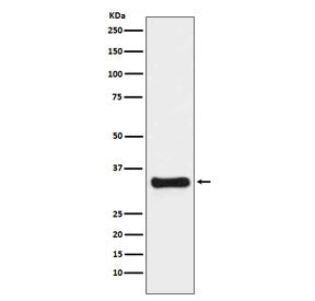 Western blot testing of human HeLa cell lysate with Thymidylate Synthase antibody. Predicted molecul