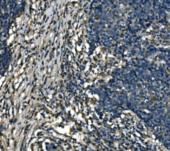 ATP6V1A Antibody / V-ATPase subunit A