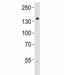 Western blot analysis of lysate from human brain tissue using TRPM8 antibody at 1:1000. Predicted mo