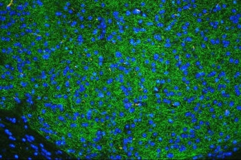 Tyrosine Hydroxylase Antibody / TH