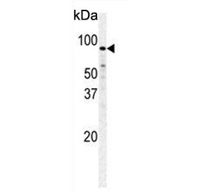 Western blot testing of human HeLa cell lysate with PFKM antibody. Predicted molecular weight ~85 kD