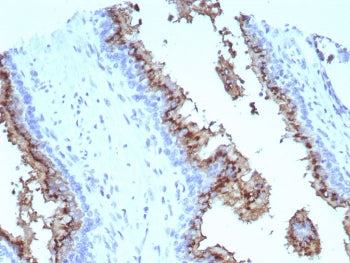 IHC staining of FFPE human prostate tissue with Prostein antibody (clone SLC45A3/7647). HIER: boil t