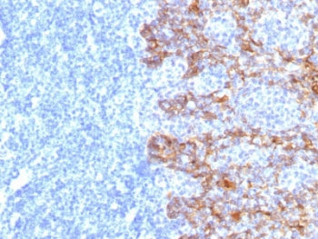 IHC staining of FFPE human tonsil tissue with Acidic Cytokeratin antibody (clone SPM115). HIER: boil