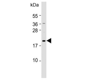 Western blot testing of human SW620 cell lysate with NUDT15 antibody. Predicted molecular weight ~19